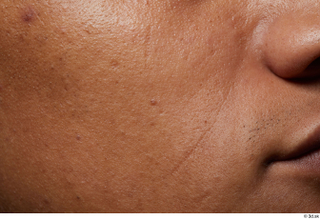 HD Face Skin Rahil Waters cheek face nose scar skin…